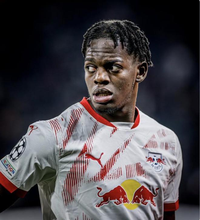 萊比錫中衛(wèi)盧克巴左大腿傷，預(yù)計(jì)傷缺兩月。